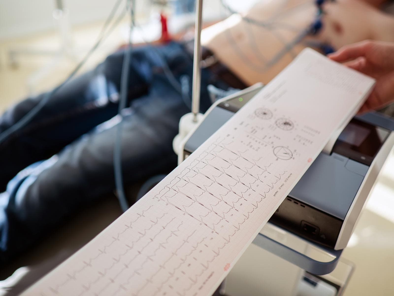 Electrocardiogramă în curs de înregistrare, cu traseul ieșind din aparat, în timp ce pacientul stă întins cu electrozii atașați
